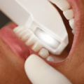 Scansione digitale del tuo sorriso