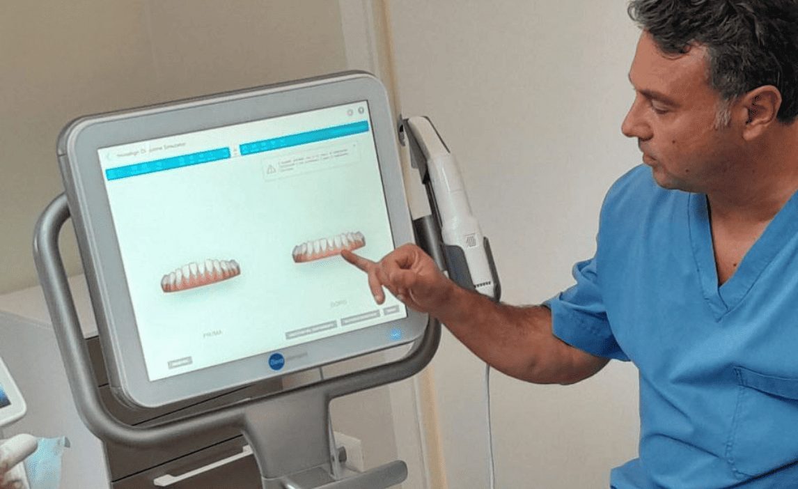 Simulazione del risultato del trattamento di ortodonzia invisibile allo Studio Recchia